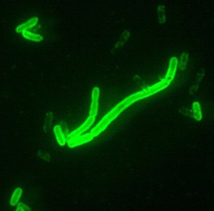 Yersinia_pestis_fluorescent