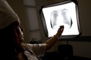 Doctor with chest X-ray
